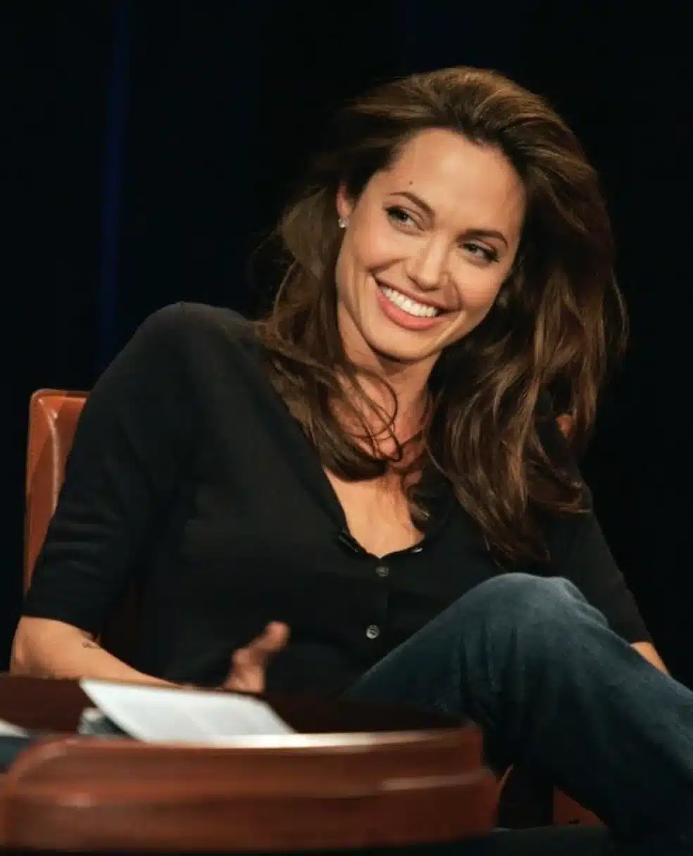 “Angelina Jolie with harmonized smile arc following lower lip curvature.”