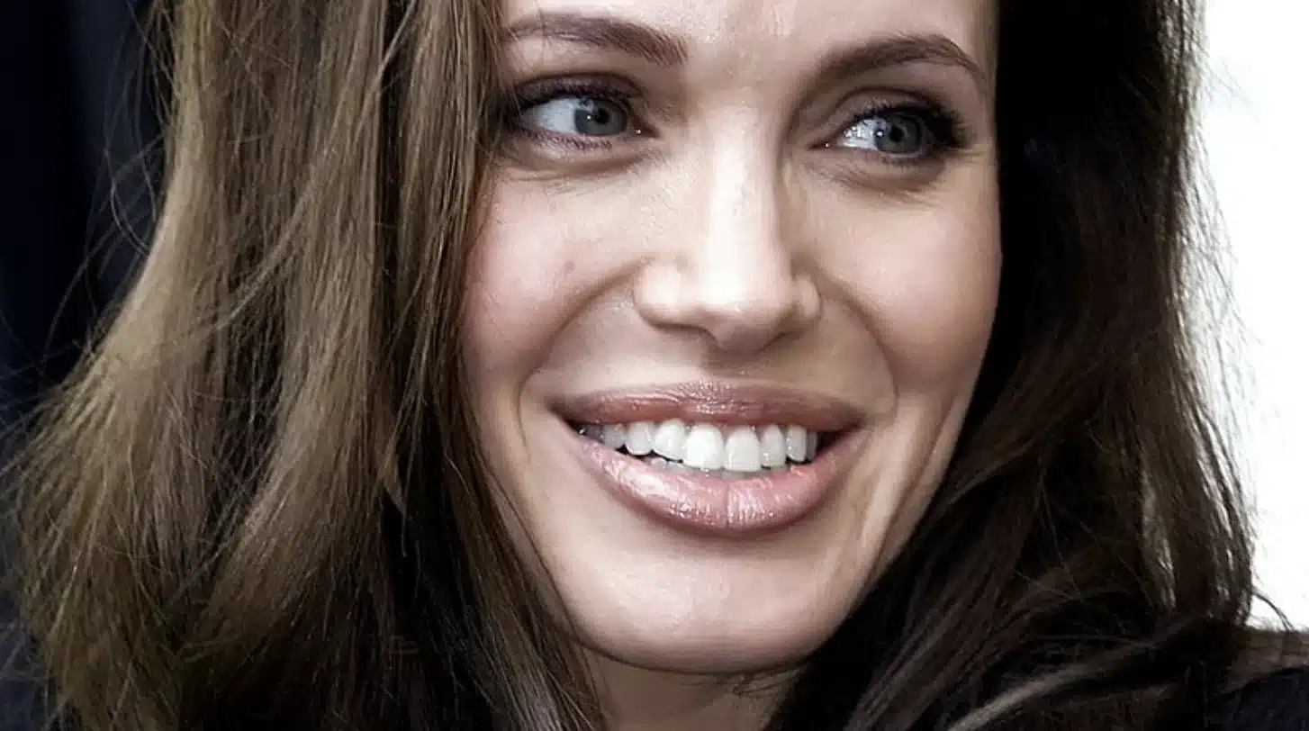 “Artistic portrait of Angelina Jolie highlighting harmony between lips and teeth.”
