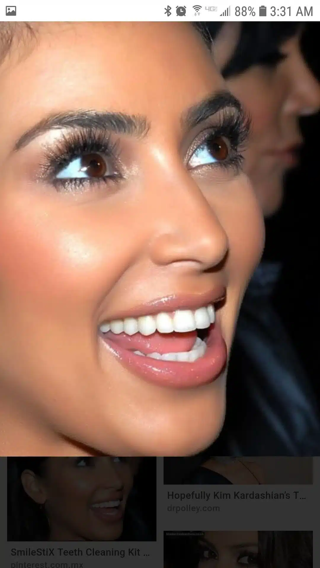 26. Kim Kardashian smile geometry integrated with facial proportions