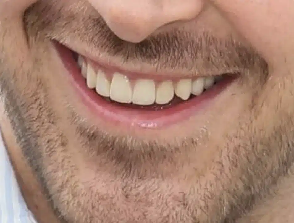 Ryan Gosling smile