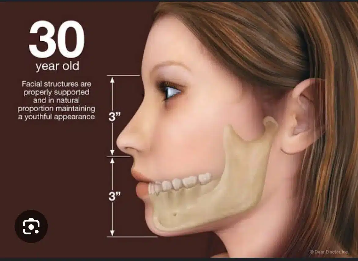 full mouth implants in turkey