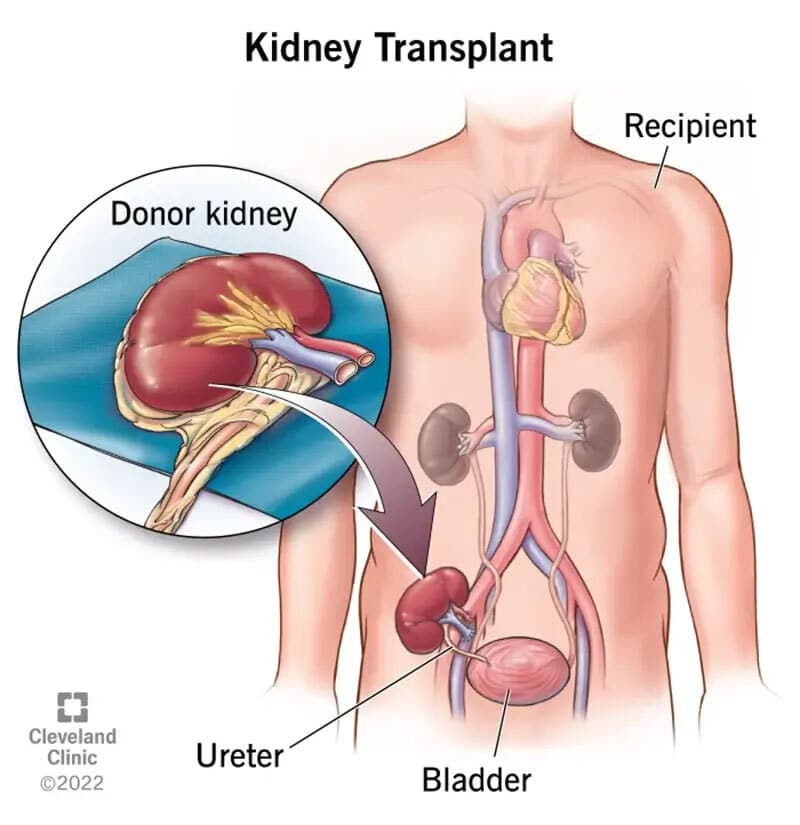 Nephrology and Kidney Care