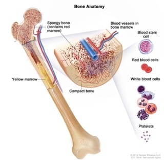 Bone Marrow transplant