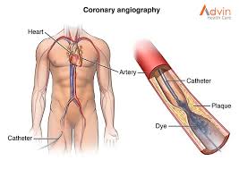 cardiovascular treatments