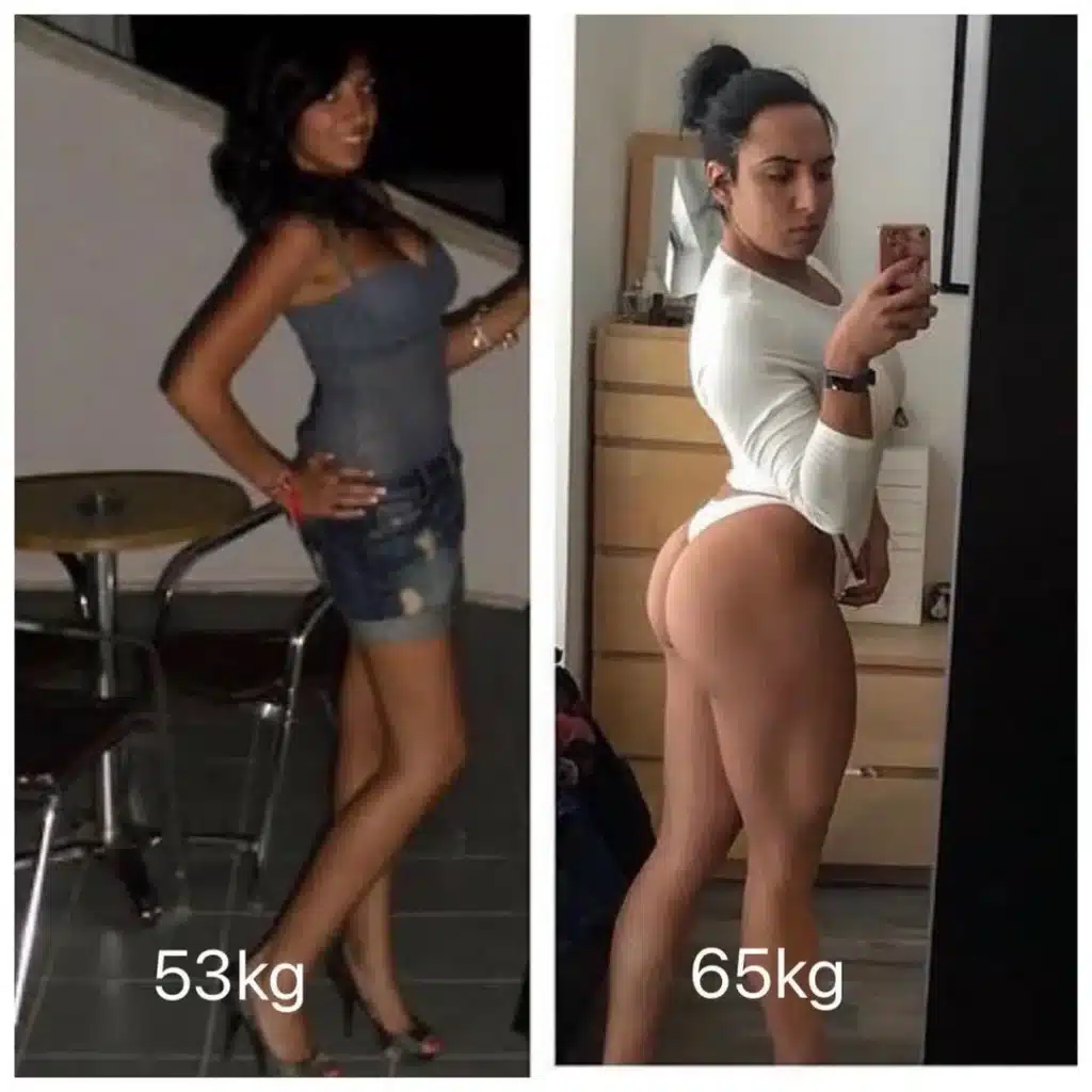 Brazilian Butt Lift 9 Postoperative mobility guidance